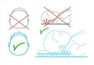Overlay 35 x 75 for Pressure Reducing Bed CPAD 1